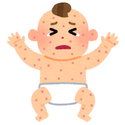 乳児湿疹のイラスト