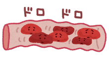 ドロドロの血管